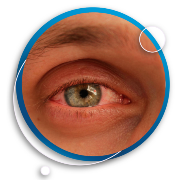 Shri Ganesh Eye Hospital | Service